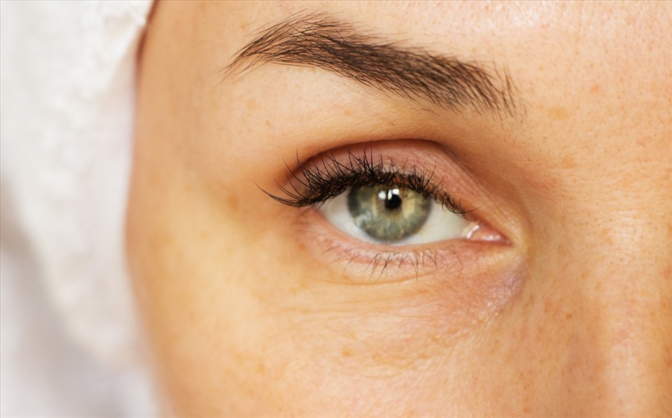 Phương pháp giúp giảm nếp nhăn vùng mắt hiệu quả
